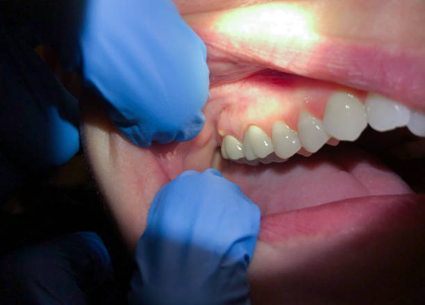 Best Emergency TMJ Treatment in Bellefontaine, OH