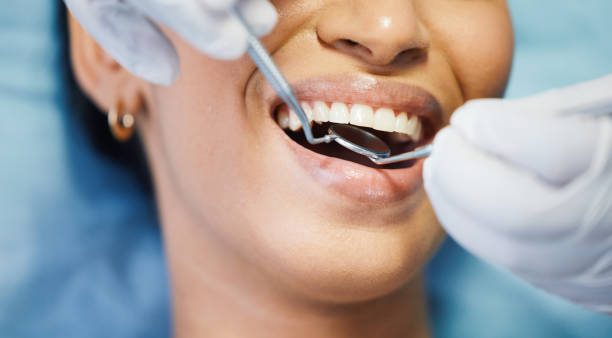 Best Pediatric Emergency Dentist in Bellefontaine, OH
