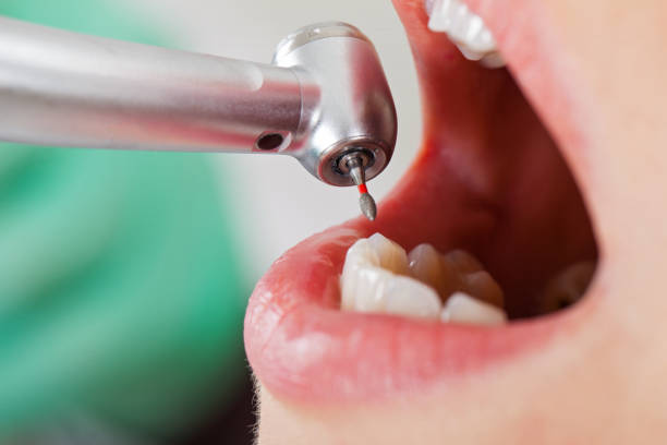 Best Emergency Denture Repair in Bellefontaine, OH